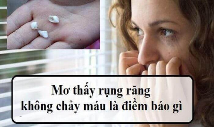 Nằm mơ rụng răng không chảy máu